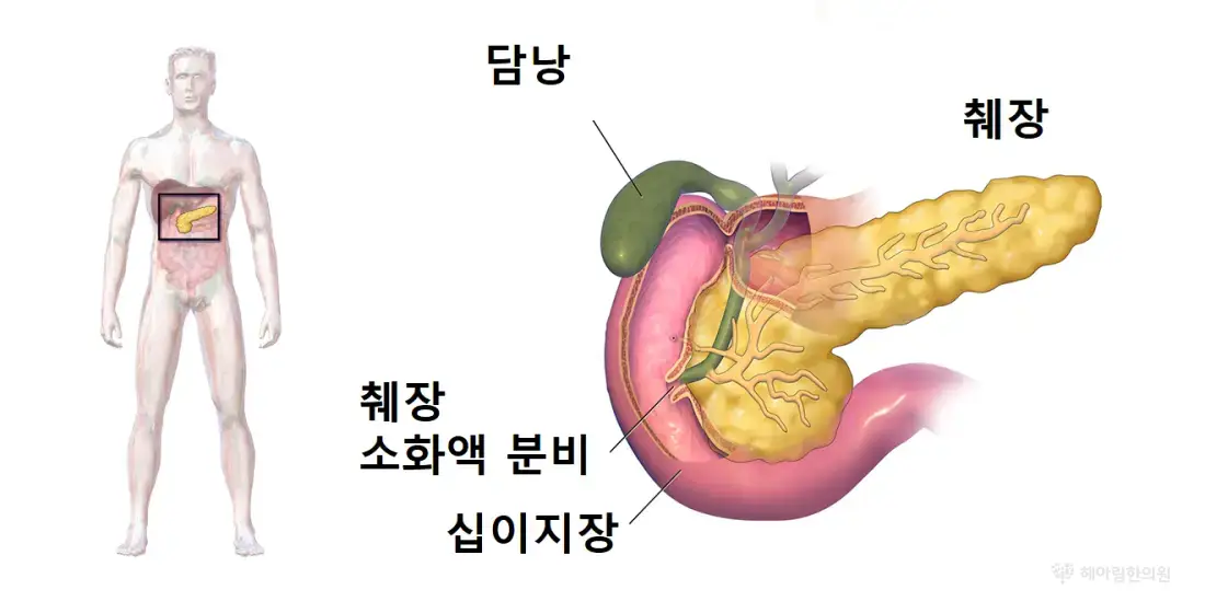 만성위장 치료 - 비허 (췌장 소화액 분비 저하)