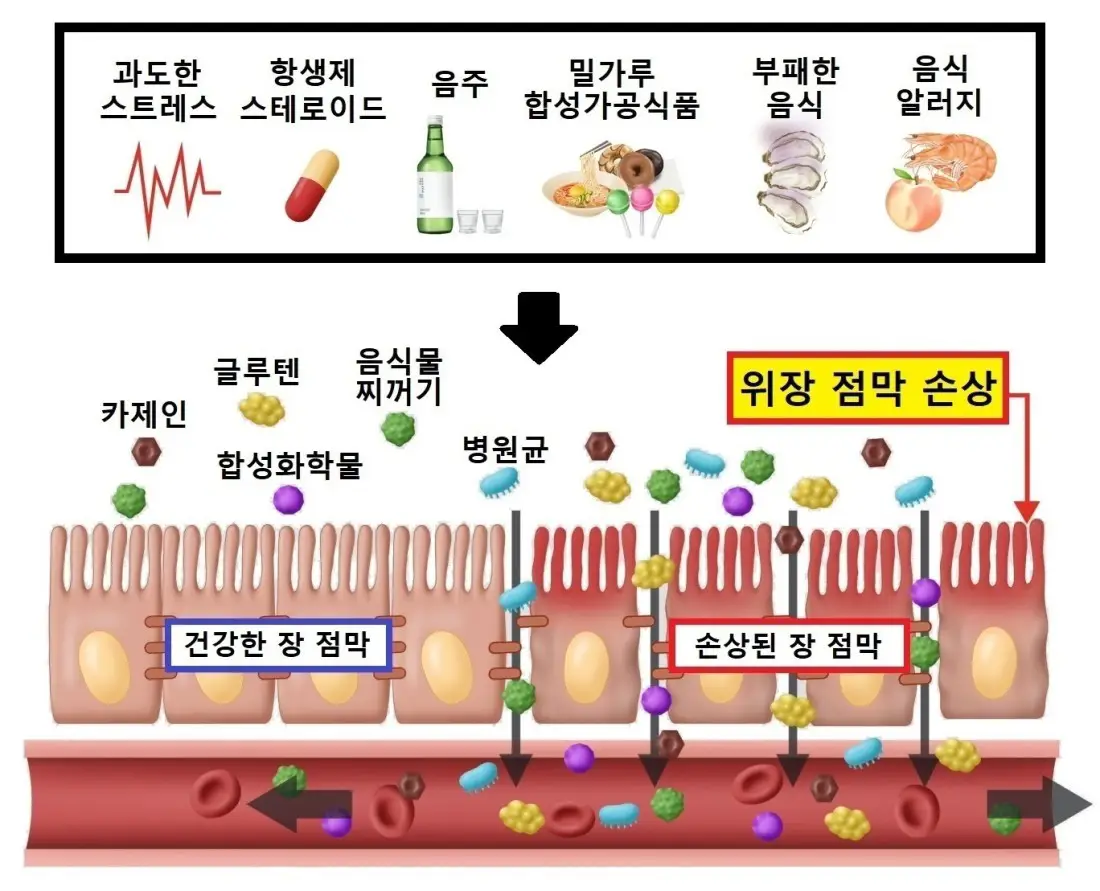피부난치 치료 - 독소 + 면역 불균형 [염증 독소]