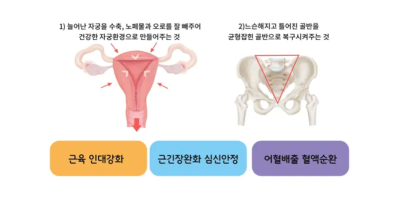 여성 부인과 치료 - 산후보약/산후체형교정/방광염